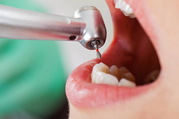 Best Walk-In Emergency Dentist in Hwatha, IA
